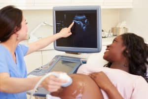 Pregnant woman having an ultrasound scan.